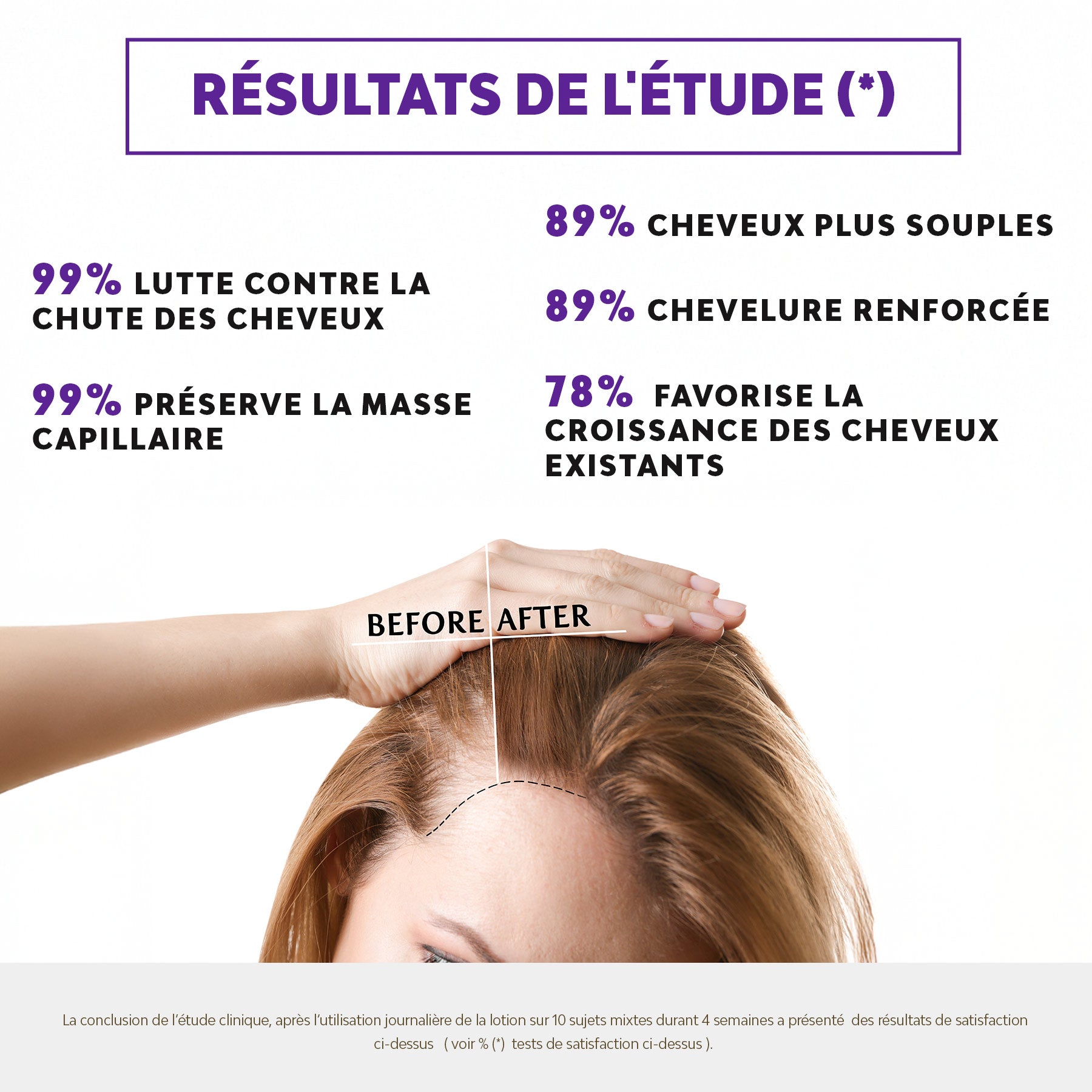 CCL+ - ANTI-HAIR LOSS LOTION PROVEN EFFICACY