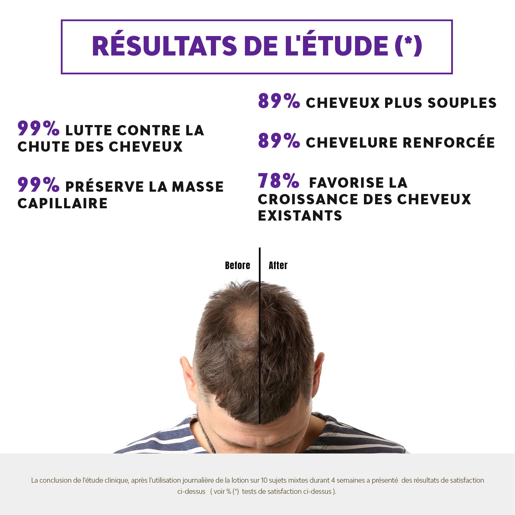 CCL+ - ANTI-HAIR LOSS LOTION PROVEN EFFICACY
